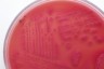 agar colonies